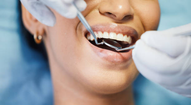 Best Emergency Dental Services for Seniors in Cedar City, UT